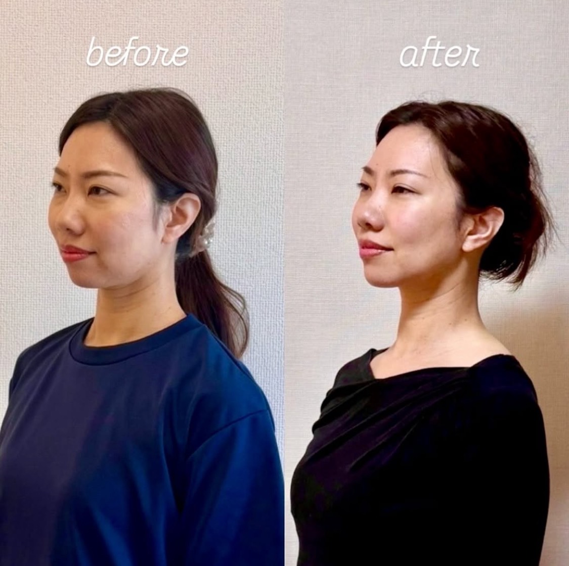 高濃度美容液を使ったスキンケア