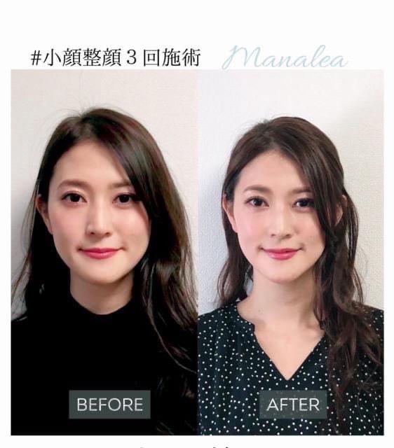 エイジングケアで若々しさを保つ